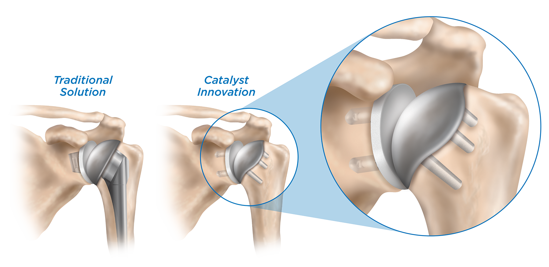 Orthopedic surgeon in The Woodlands first in Texas to offer